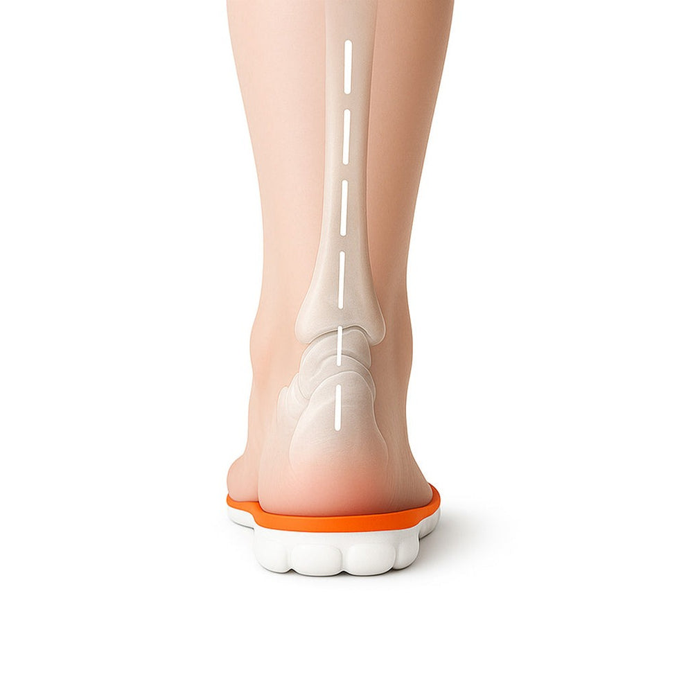 Antes de usar Plantillas SENSO